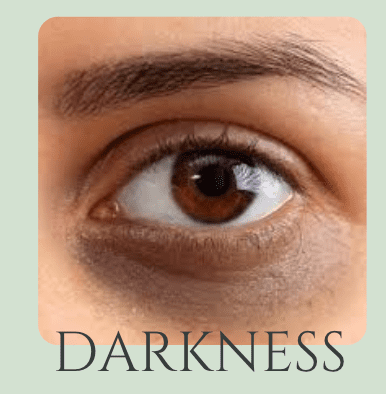under eye darkness