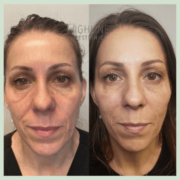 real under eye clients