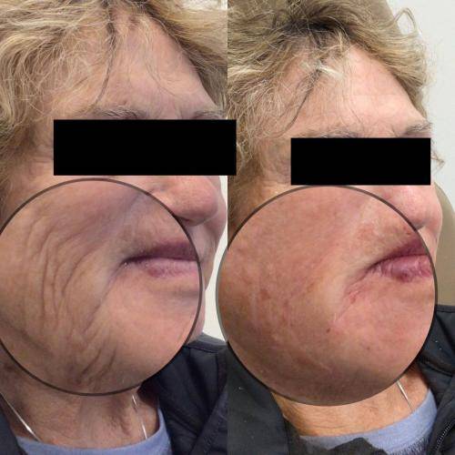 0E4A51B4-D5E1-44CA-949F-21C8DB8C2B1F