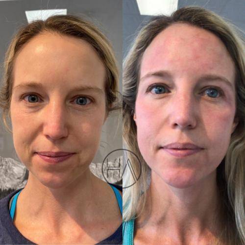 139EB2A6-797E-4207-A929-388C2A99CE38