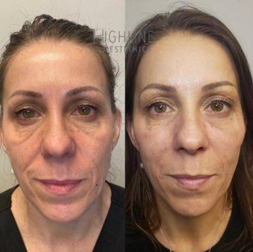 25C29458-B143-428A-8EFB-C734D18ECD0D