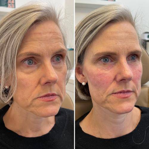 25F17713-A78D-437F-AE10-A4E5CBD08C00