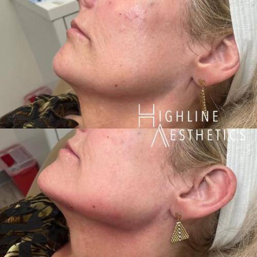 32256249-3C02-48E5-A8D4-2CA5BB26DDE7