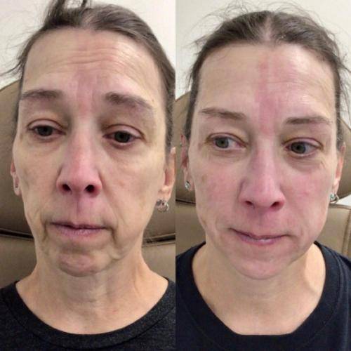 3E104238-DFEA-4C90-B6B0-1F9A0053A665