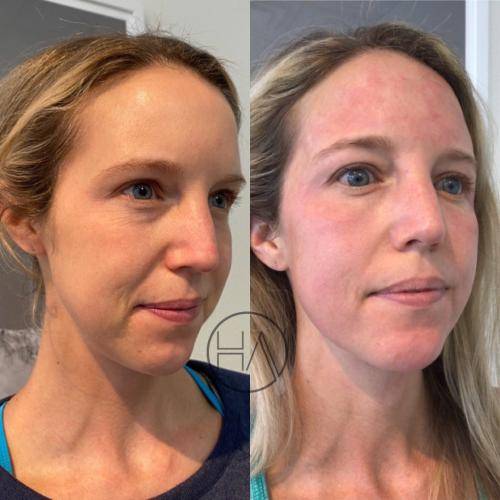 46181172-525D-499F-84C1-02BF506799AB