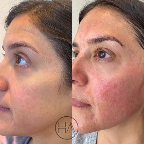 67EED96D-FB42-4030-A870-69CEEA84983F