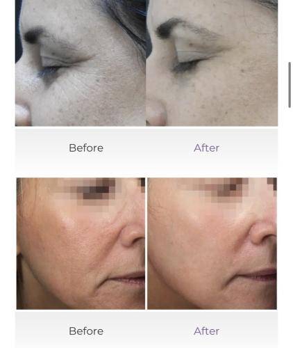 70601704-7D73-42AA-B49D-5A9F21CC8DEC_1_105_c