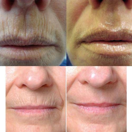 7653832C-C893-4772-A2EB-F7531E5FEF95_1_105_c