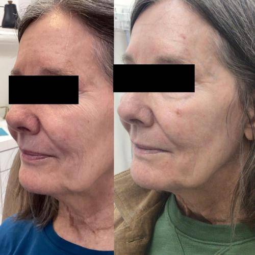 79408FC8-94BD-4611-8ED9-2EF1422D23D3