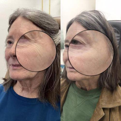 7B63B4DF-FCF0-4378-806B-CD2A603CA575