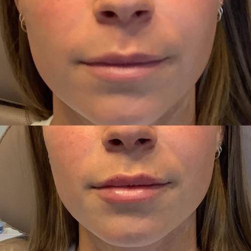 8E90E4CF-7A76-4407-98D0-F9A7D4544AE1_1_105_c