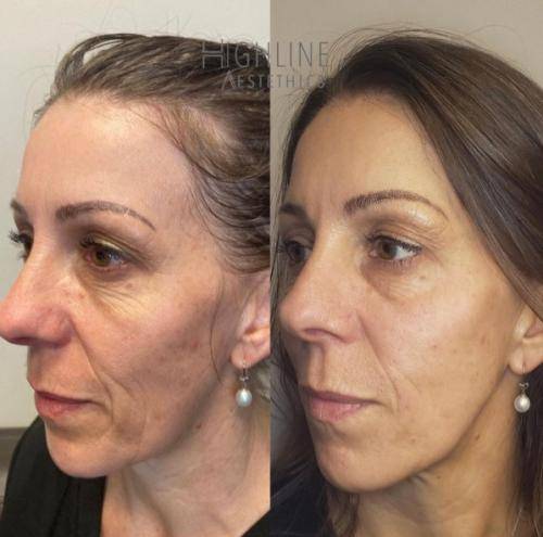 AC33C09B-991B-4443-B58E-D4C4980E354E