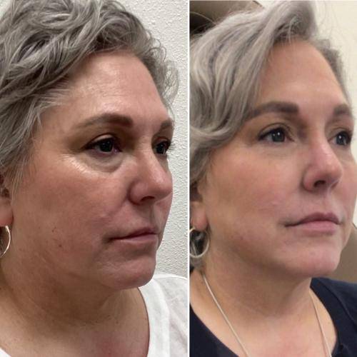 B1945C96-E1D0-42C4-9934-E82CDBF0663D