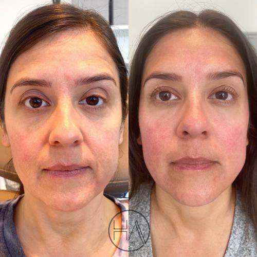 BD8E4C78-7B92-4AA7-A929-03C3F7A1B48F