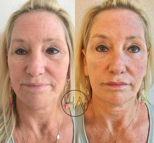 F04C7591-2251-42CB-8211-BACCEACFF6C3