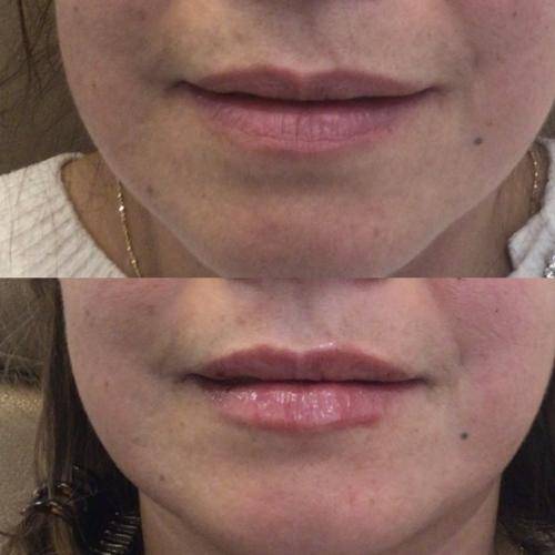 F1F5869D-4E4A-449F-BAE4-4E3BA41FB3AA_1_105_c