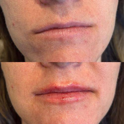 F2039611-9002-4789-AA85-71A482698F80_1_105_c