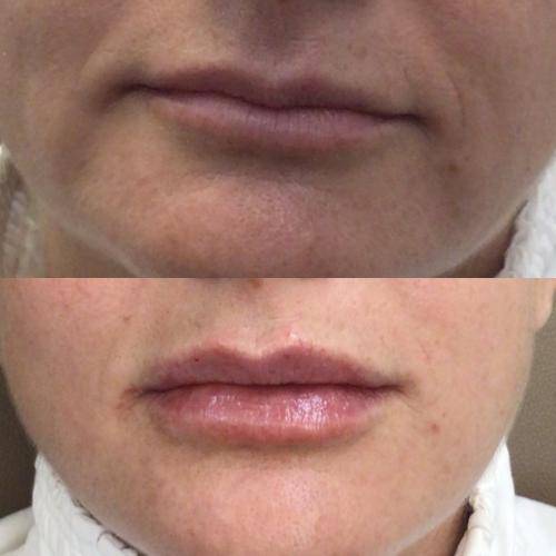 F36B9A4D-2637-4F7F-BBC6-6439091E8259_1_105_c