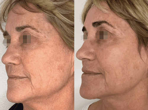 Screenshot 2023-11-14 at 9.30.33 PM