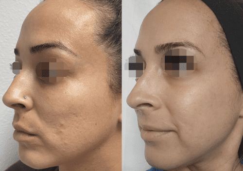 Screenshot 2023-11-14 at 9.30.41 PM