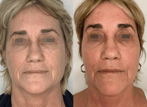 Screenshot 2023-11-14 at 9.30.59 PM